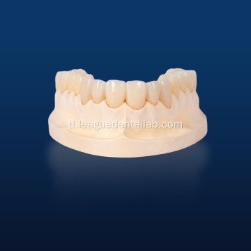 Kalidad ng Foinoe Dental Multilayered Zirconia